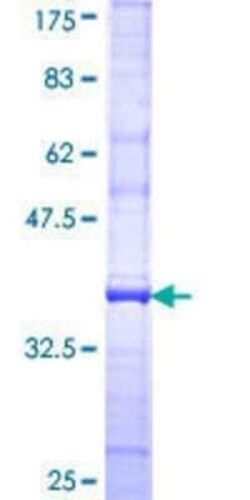 Novus Biologicals Recombinant Human CMAH GST (N-Term) Protein 25 &mu;g | Buy Online | Novus Biologicals&trade; | Fisher Scientific