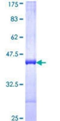 Novus Biologicals Recombinant Human BBOX1 GST (N-Term) Protein 25 &mu;g | Buy Online | Novus Biologicals&trade; | Fisher Scientific