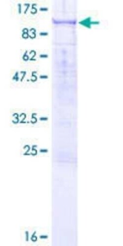 Novus Biologicals Recombinant Human RASAL1 GST (N-Term) Protein 10 &mu;g | Buy Online | Novus Biologicals&trade; | Fisher Scientific