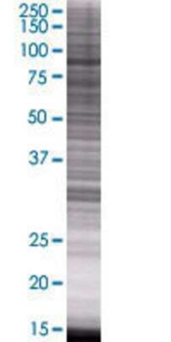Novus Biologicals RASAL1 293T Cell Transient Overexpression Lysate 0.1 mL | Buy Online | Novus Biologicals&trade; | Fisher Scientific