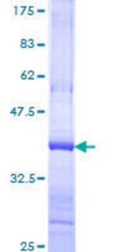Novus Biologicals Recombinant Human NSMAF GST (N-Term) Protein 25 &mu;g | Buy Online | Novus Biologicals&trade; | Fisher Scientific