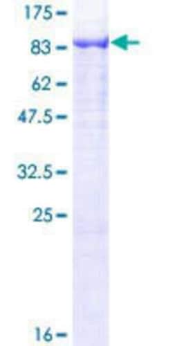 Novus Biologicals&trade;&nbsp;Recombinant Human GNPAT GST (N-Term) Protein