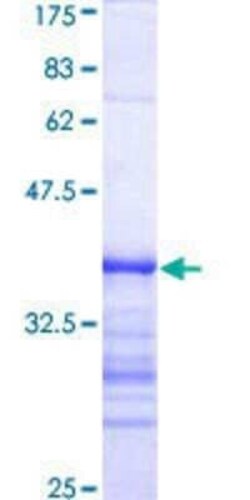 Novus Biologicals Recombinant Human DYRK2 GST (N-Term) Protein 10 &mu;g | Buy Online | Novus Biologicals&trade; | Fisher Scientific
