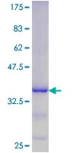 Novus Biologicals Recombinant Human DUSP11 GST (N-Term) Protein 10 &mu;g | Buy Online | Novus Biologicals&trade; | Fisher Scientific