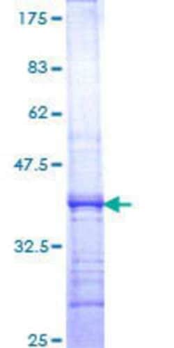 Novus Biologicals Recombinant Human DHX16 GST (N-Term) Protein 10 &mu;g | Buy Online | Novus Biologicals&trade; | Fisher Scientific