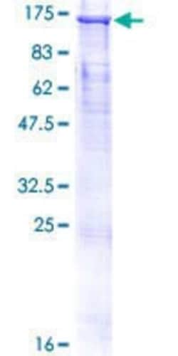 Novus Biologicals Recombinant Human CUL4B GST (N-Term) Protein 10 &mu;g | Buy Online | Novus Biologicals&trade; | Fisher Scientific