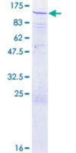 Novus Biologicals Recombinant Human Cullin 3 GST (N-Term) Protein 2 &mu;g | Buy Online | Novus Biologicals&trade; | Fisher Scientific