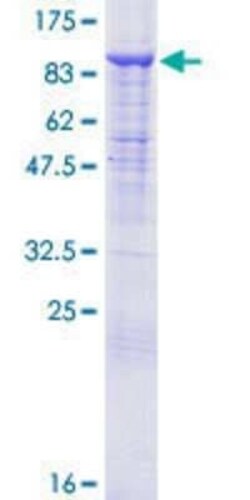 Novus Biologicals Recombinant Human Cullin 2 GST (N-Term) Protein 25 &mu;g | Buy Online | Novus Biologicals&trade; | Fisher Scientific