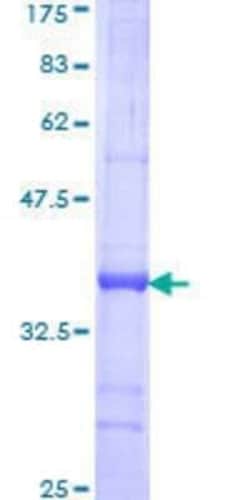 Novus Biologicals Recombinant Human TEAD2 GST (N-Term) Protein 10 &mu;g | Buy Online | Novus Biologicals&trade; | Fisher Scientific