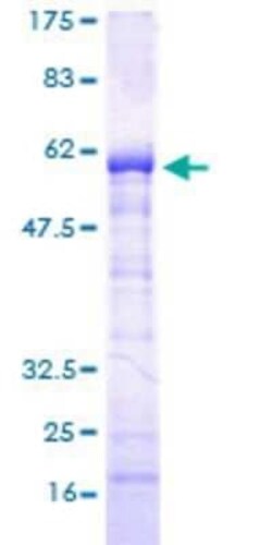 Novus Biologicals Recombinant Human SPT3 GST (N-Term) Protein 25 &mu;g | Buy Online | Novus Biologicals&trade; | Fisher Scientific