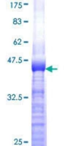 Novus Biologicals Recombinant Human IRS4 GST (N-Term) Protein 2 &mu;g | Buy Online | Novus Biologicals&trade; | Fisher Scientific