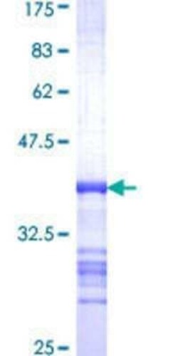 Novus Biologicals Recombinant Human MRCK GST (N-Term) Protein 10 &mu;g | Buy Online | Novus Biologicals&trade; | Fisher Scientific