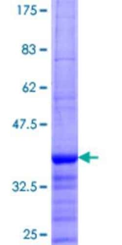 Novus Biologicals Recombinant Human Neurotrypsin GST (N-Term) Protein 25 &mu;g | Buy Online | Novus Biologicals&trade; | Fisher Scientific