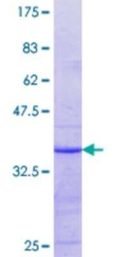 Novus Biologicals Recombinant Human LAT3 GST (N-Term) Protein 25 &mu;g | Buy Online | Novus Biologicals&trade; | Fisher Scientific
