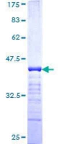 Novus Biologicals Recombinant Human Plakophilin 4 GST (N-Term) Protein 25 &mu;g | Buy Online | Novus Biologicals&trade; | Fisher Scientific