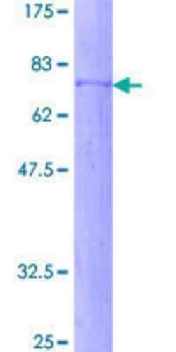 Novus Biologicals Recombinant Human PI 3-Kinase p55 gamma GST (N-Term) Protein 25 &mu;g | Buy Online | Novus Biologicals&trade; | Fisher Scientific