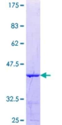 Novus Biologicals Recombinant Human PARG GST (N-Term) Protein 25 &mu;g | Buy Online | Novus Biologicals&trade; | Fisher Scientific
