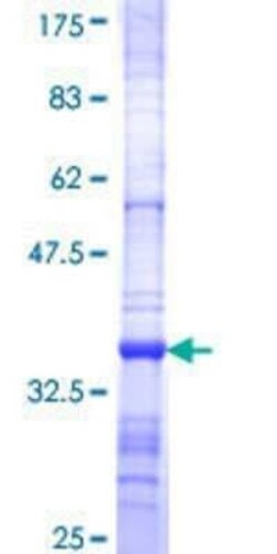 Novus Biologicals Recombinant Human ENC1 GST (N-Term) Protein 10 &mu;g | Buy Online | Novus Biologicals&trade; | Fisher Scientific