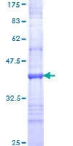 Novus Biologicals Recombinant Human Integrin alpha 8 GST (N-Term) Protein 10 &mu;g | Buy Online | Novus Biologicals&trade; | Fisher Scientific