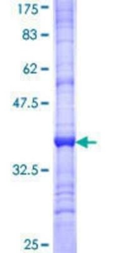 Novus Biologicals Recombinant Human IKBKAP GST (N-Term) Protein 25 &mu;g | Buy Online | Novus Biologicals&trade; | Fisher Scientific