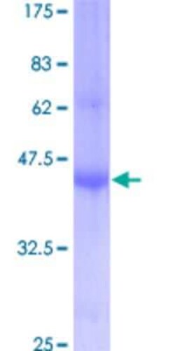 Novus Biologicals&trade;&nbsp;Recombinant Human IFITM1 GST (N-Term) Protein