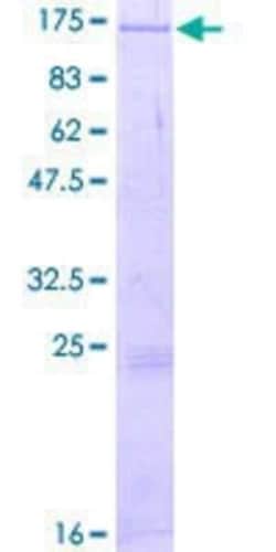 Novus Biologicals Recombinant Human DGK-zeta GST (N-Term) Protein 2 &mu;g | Buy Online | Novus Biologicals&trade; | Fisher Scientific