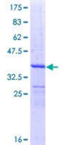 Novus Biologicals Recombinant Human DDO GST (N-Term) Protein 10 &mu;g | Buy Online | Novus Biologicals&trade; | Fisher Scientific