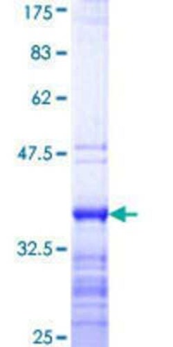 Novus Biologicals™ Recombinant Human DBPA GST (N-Term) Protein