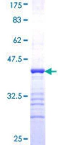 Novus Biologicals Recombinant Human COP9 GST (N-Term) Protein 25 &mu;g | Buy Online | Novus Biologicals&trade; | Fisher Scientific