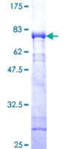 Novus Biologicals Recombinant Human CaM Kinase I GST (N-Term) Protein 10 &mu;g | Buy Online | Novus Biologicals&trade; | Fisher Scientific