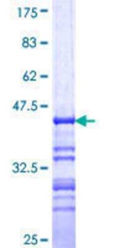 Novus Biologicals Recombinant Human BCAS1 GST (N-Term) Protein 10 &mu;g | Buy Online | Novus Biologicals&trade; | Fisher Scientific