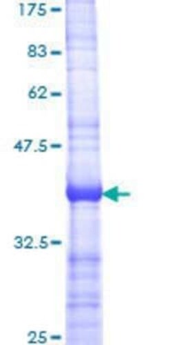 Novus Biologicals Recombinant Human API5 GST (N-Term) Protein 2 &mu;g | Buy Online | Novus Biologicals&trade; | Fisher Scientific
