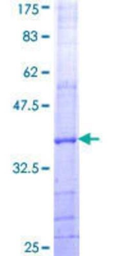 Novus Biologicals Recombinant Human AGPS GST (N-Term) Protein 25 &mu;g | Buy Online | Novus Biologicals&trade; | Fisher Scientific