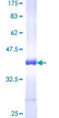 Novus Biologicals Recombinant Human AP3B1 GST (N-Term) Protein 25 &mu;g | Buy Online | Novus Biologicals&trade; | Fisher Scientific