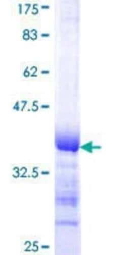 Novus Biologicals Recombinant Human BLZF1 GST (N-Term) Protein 10 &mu;g | Buy Online | Novus Biologicals&trade; | Fisher Scientific