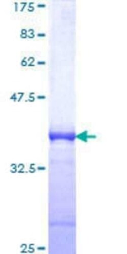 Novus Biologicals Recombinant Human DEC1 GST (N-Term) Protein 10 &mu;g | Buy Online | Novus Biologicals&trade; | Fisher Scientific