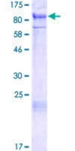 Novus Biologicals Recombinant Human PIAS1 GST (N-Term) Protein 2 &mu;g | Buy Online | Novus Biologicals&trade; | Fisher Scientific