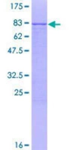 Novus Biologicals Recombinant Human Cdc14B GST (N-Term) Protein 2 &mu;g | Buy Online | Novus Biologicals&trade; | Fisher Scientific