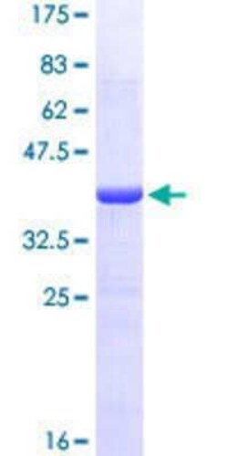 Novus Biologicals Recombinant Human Cdc14B GST (N-Term) Protein 10 &mu;g | Buy Online | Novus Biologicals&trade; | Fisher Scientific