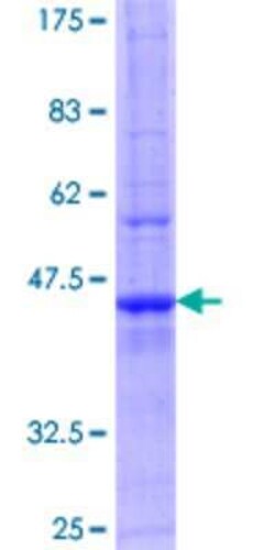 Novus Biologicals Recombinant Human TCAP GST (N-Term) Protein 25 &mu;g | Buy Online | Novus Biologicals&trade; | Fisher Scientific