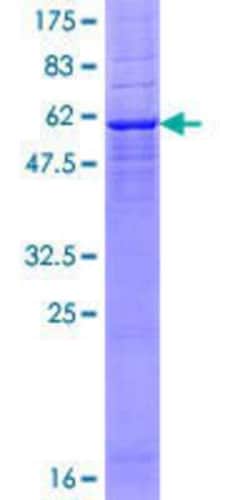 Novus Biologicals™ Recombinant Human DEGS1 GST (N-Term) Protein