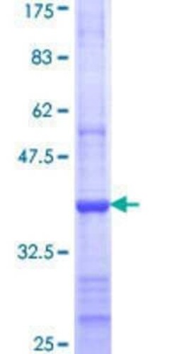 Novus Biologicals™ Recombinant Human DEGS1 GST (N-Term) Protein