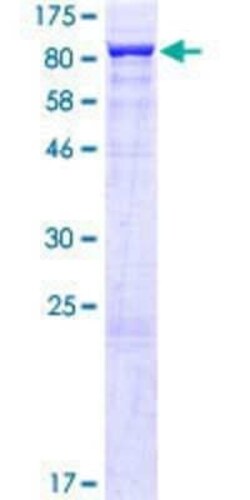 Novus Biologicals Recombinant Human THOC5 GST (N-Term) Protein 10 &mu;g | Buy Online | Novus Biologicals&trade; | Fisher Scientific