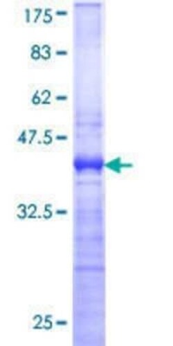 Novus Biologicals Recombinant Human MNK1 GST (N-Term) Protein 25 &mu;g | Buy Online | Novus Biologicals&trade; | Fisher Scientific