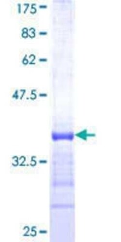 Novus Biologicals Recombinant Human KHSRP GST (N-Term) Protein 25 &mu;g | Buy Online | Novus Biologicals&trade; | Fisher Scientific