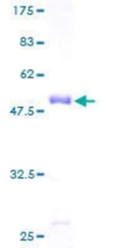 Novus Biologicals Recombinant Human PDLIM4 GST (N-Term) Protein 10 &mu;g | Buy Online | Novus Biologicals&trade; | Fisher Scientific