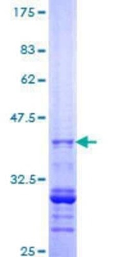 Novus Biologicals Recombinant Human RGS20 GST (N-Term) Protein 10 &mu;g | Buy Online | Novus Biologicals&trade; | Fisher Scientific