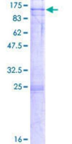 Novus Biologicals Recombinant Human NOP14 GST (N-Term) Protein 2 &mu;g | Buy Online | Novus Biologicals&trade; | Fisher Scientific