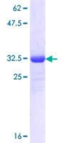 Novus Biologicals Recombinant Human SLC25A12 GST (N-Term) Protein 10 &mu;g | Buy Online | Novus Biologicals&trade; | Fisher Scientific