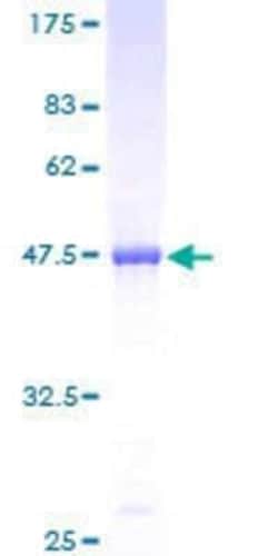 Novus Biologicals Recombinant Human PLA2G4C GST (N-Term) Protein 10 &mu;g | Buy Online | Novus Biologicals&trade; | Fisher Scientific